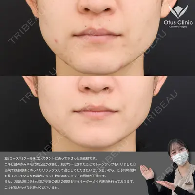 Otus Clinic 【オータスクリニック】 中 徳太郎医師の症例