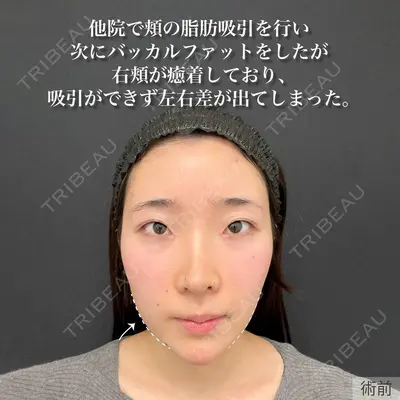 東京シンデレラ美容外科 新宿院 吉原 伯医師の症例