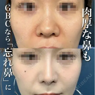 グローバルビューティークリニック 銀座院 理事長　杉崎　裕斗医師の症例