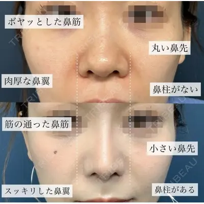 グローバルビューティークリニック 銀座院 理事長　杉崎　裕斗医師の症例