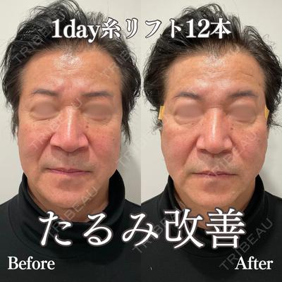 REVO CLINIC PLUS 結城 直哉医師の症例