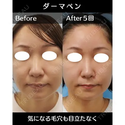 麹町皮ふ科・形成外科クリニックの症例
