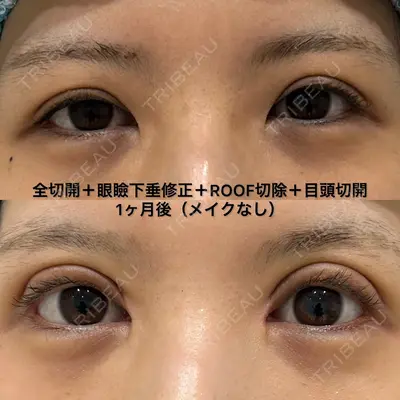 エターナル美容クリニック 久門田 詳医師の症例