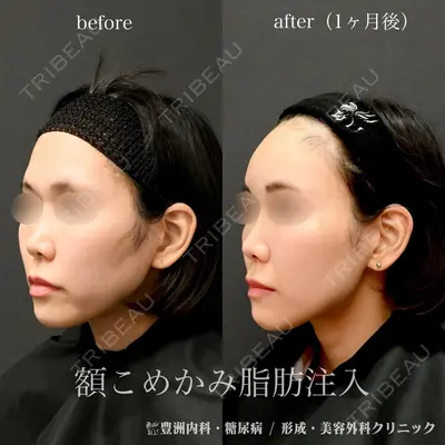 豊洲内科・糖尿病 / 形成・美容外科クリニック 澤口 悠医師の症例