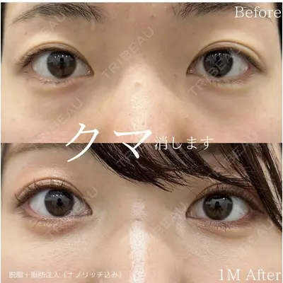 ルラ美容クリニック 新潟院の症例