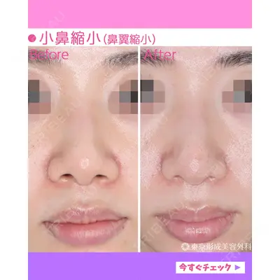 東京形成美容外科 船橋院の症例