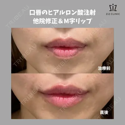 ziz CLINICの症例
