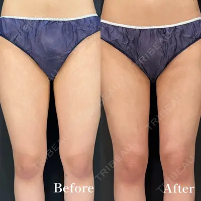 HAAB BEAUTY CLINIC 名古屋院の症例