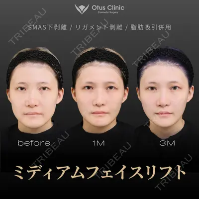 Otus Clinic 【オータスクリニック】 中 徳太郎医師の症例