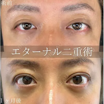 ルラ美容クリニック 札幌本院の症例