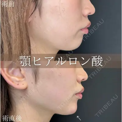 ルラ美容クリニック 名古屋栄院 / ルラスキンクリニック 名古屋栄院の症例