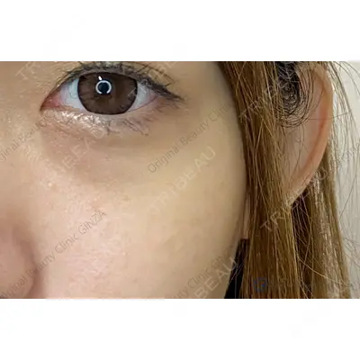 Original Beauty Clinic GINZA 佐藤玲史医師の症例