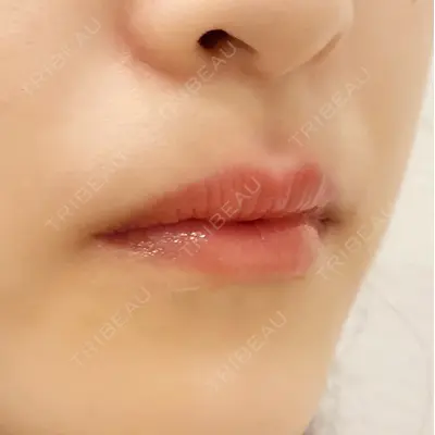 A CLINIC（エークリニック） 横浜院の症例