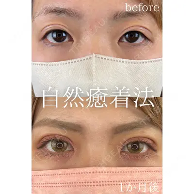 ルラ美容クリニック 大阪本院 平田 一記医師の症例