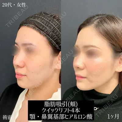 東京シンデレラ美容外科 大宮院の症例