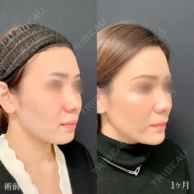 東京シンデレラ美容外科 大宮院の症例