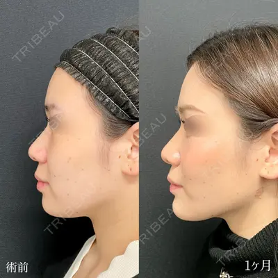 東京シンデレラ美容外科 大宮院の症例