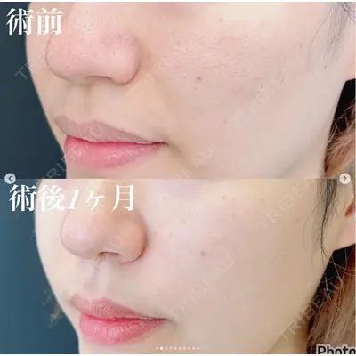ルラ美容クリニック 横浜院 金子 真也医師の症例