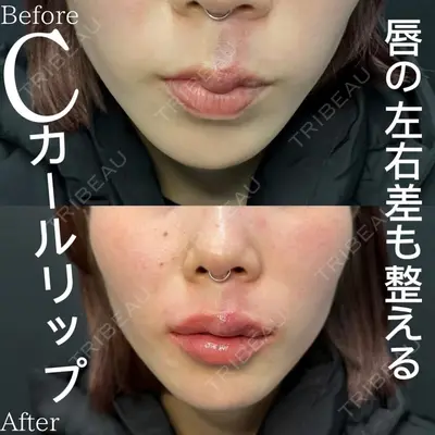 ルラ美容クリニック 渋谷本院の症例