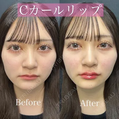 ルラ美容クリニック 渋谷本院 昼間 路子医師の症例