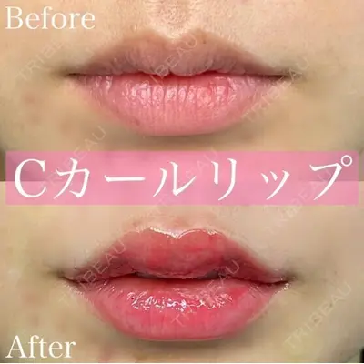 ルラ美容クリニック 渋谷本院 昼間 路子医師の症例