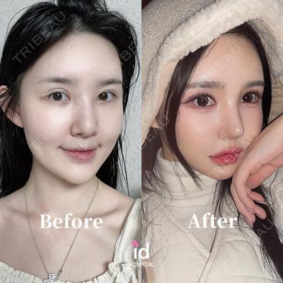 id（アイディ）美容外科の症例