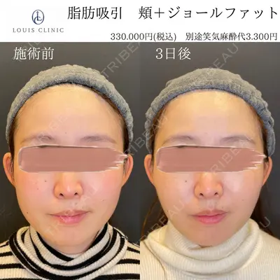 LOUIS CLINIC 二子玉川院【ルイクリニック】 小松 塁医師の症例