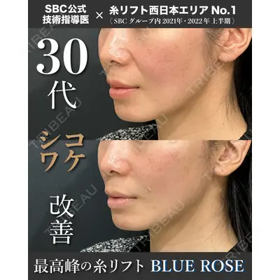 湘南美容クリニック 大阪四ツ橋院 植田 一樹医師の症例