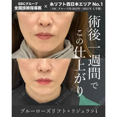 湘南美容クリニック 大阪四ツ橋院 植田 一樹医師の症例