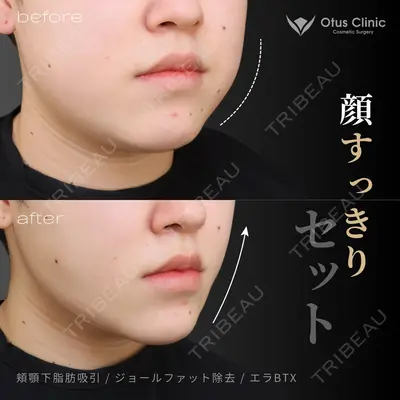 Otus Clinic 【オータスクリニック】 中 徳太郎医師の症例