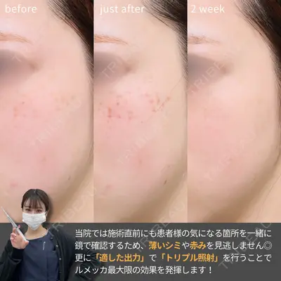 Otus Clinic 【オータスクリニック】 中 徳太郎医師の症例