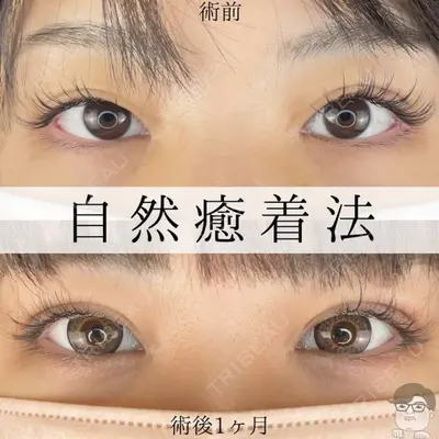 ルラ美容クリニック 札幌本院 佐藤 雄紀医師の症例