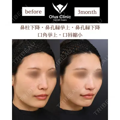 Otus Clinic 【オータスクリニック】 中 徳太郎医師の症例