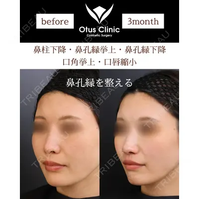 Otus Clinic 【オータスクリニック】 中 徳太郎医師の症例