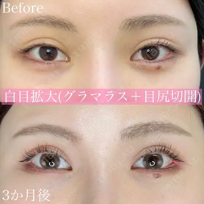 ルラ美容クリニック 渋谷本院の症例