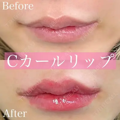 ルラ美容クリニック 新潟院の症例
