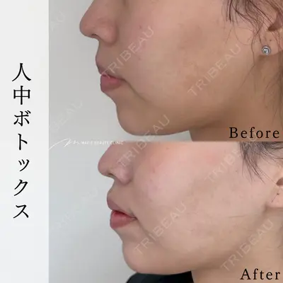 Mavie Beauty Clinic （マヴィービューティークリニック）の症例