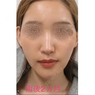 銀座TAクリニック 山田 真里江医師の症例