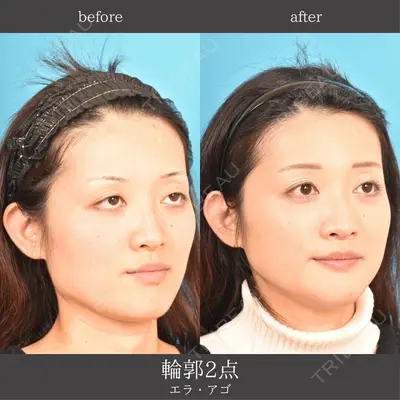 アネシス美容クリニック 水野　力医師の症例