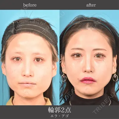 アネシス美容クリニック 水野　力医師の症例