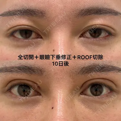 エターナル美容クリニック 久門田 詳医師の症例