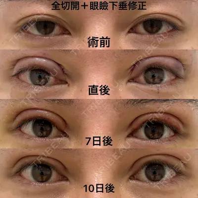 エターナル美容クリニック 久門田 詳医師の症例