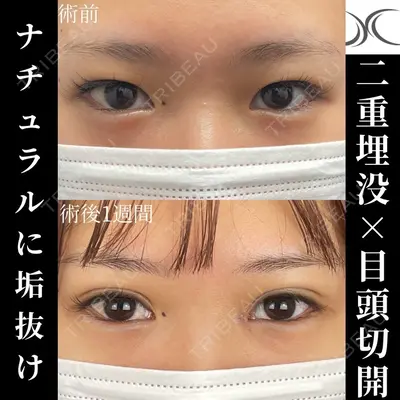 ネビュラクリニック 京都院 岸 大輔医師の症例