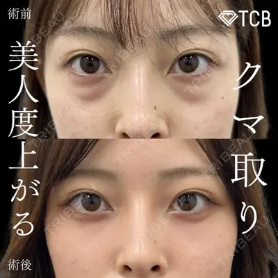 TCB東京中央美容外科 越谷院の症例