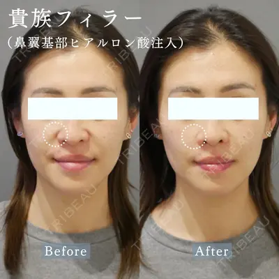 ARTE BEAUTY CLINICの症例