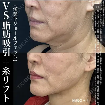 湘南美容クリニック 名古屋駅本院 豊嶋 沙良（育休中のため指名不可）医師の症例