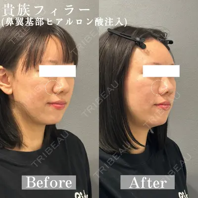 ARTE BEAUTY CLINICの症例