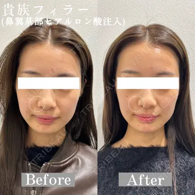 ARTE BEAUTY CLINICの症例