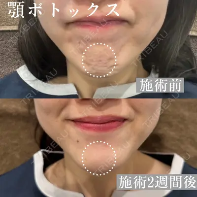 ARTE BEAUTY CLINICの症例