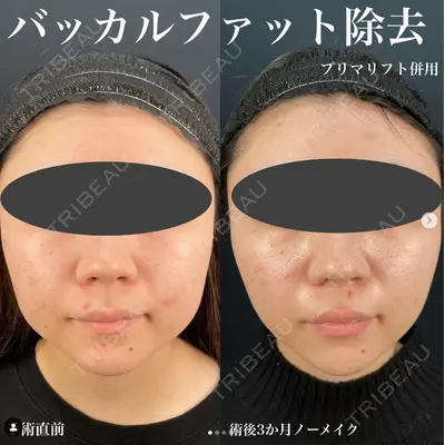 湘南美容クリニック 千葉センシティ院の症例